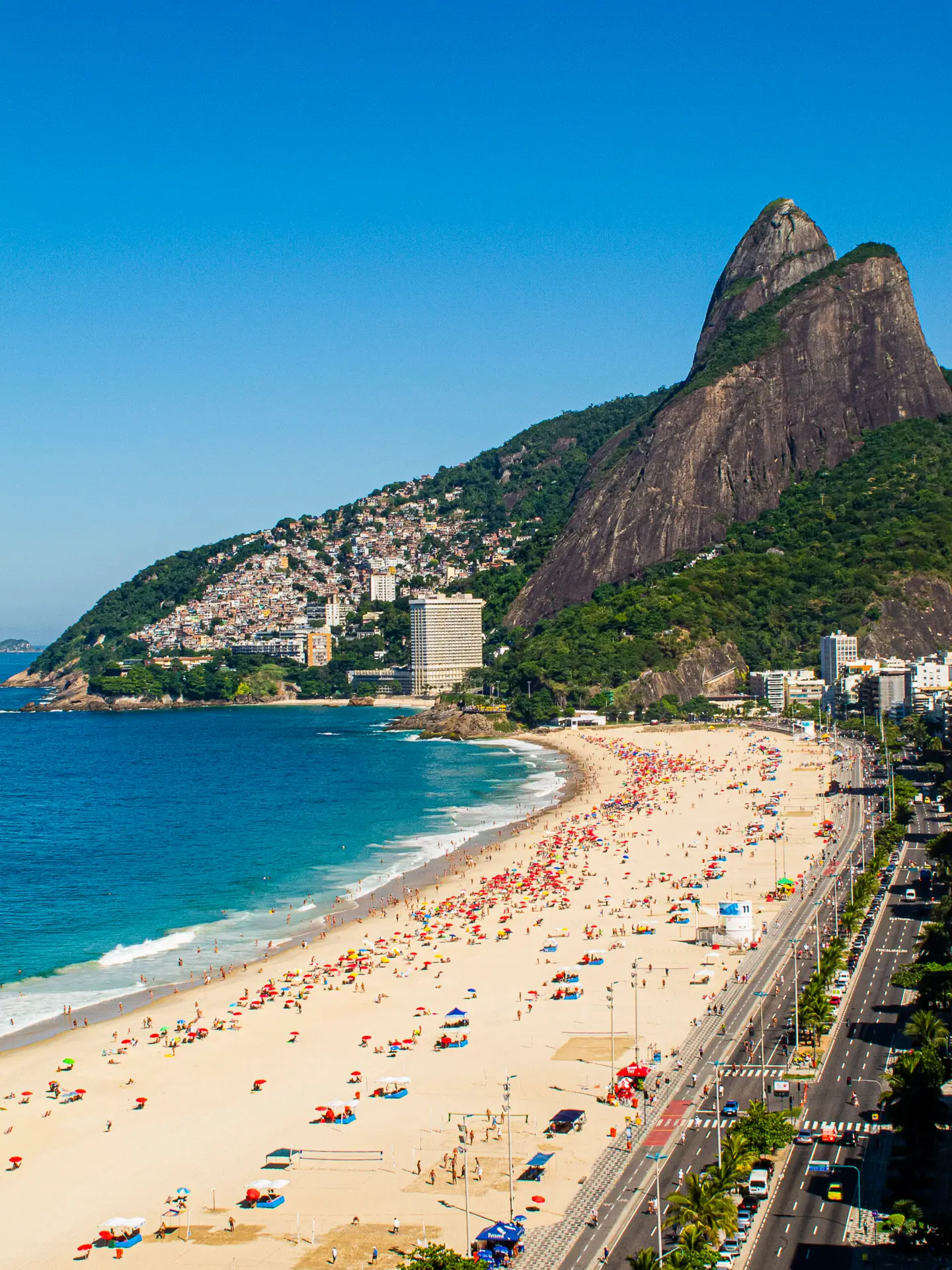 Minimally Invasive Tummy Tuck (M.I.L.A) in Rio de Janeiro, Brazil by Dr. Alexandre Charão