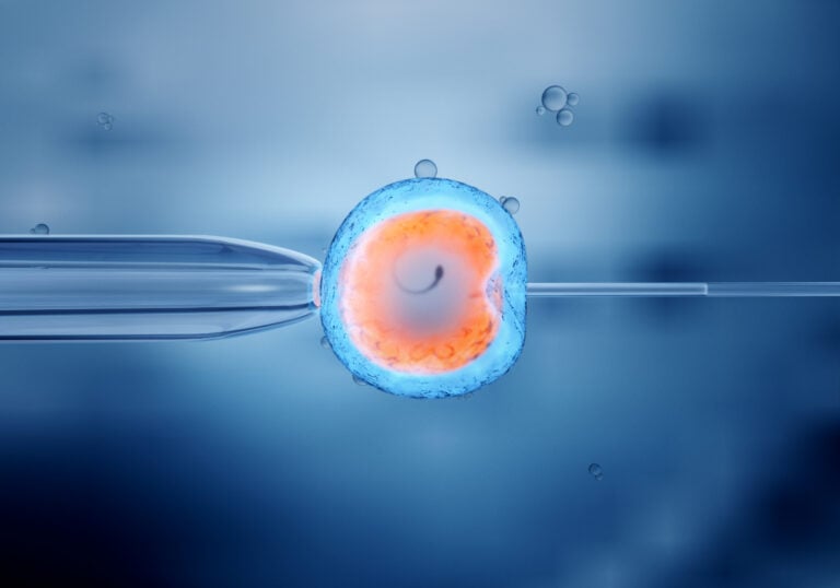 IVF in Istanbul, Turkey by Memorial Hospital