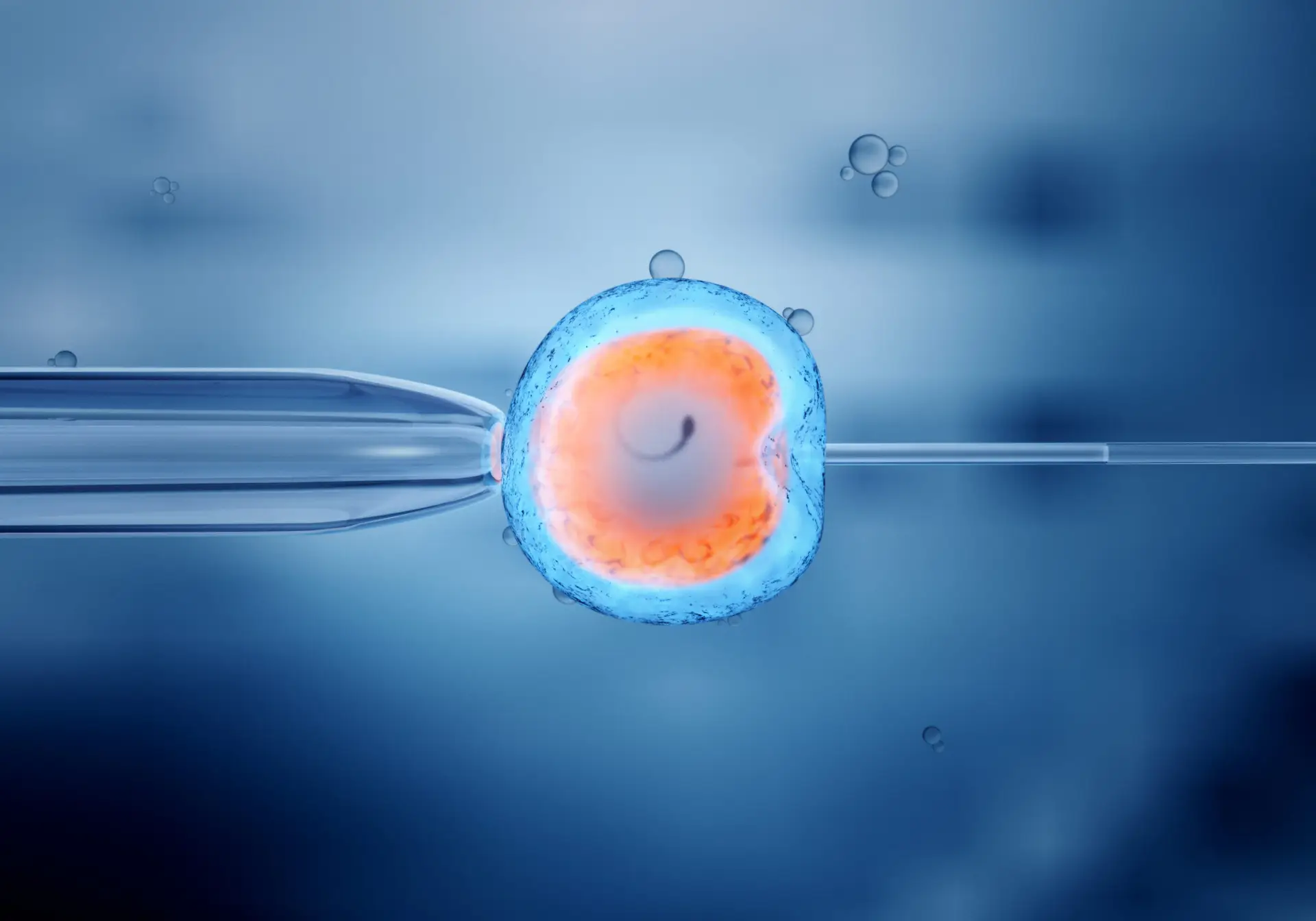 IVF Treatment in San Jose, Costa Rica