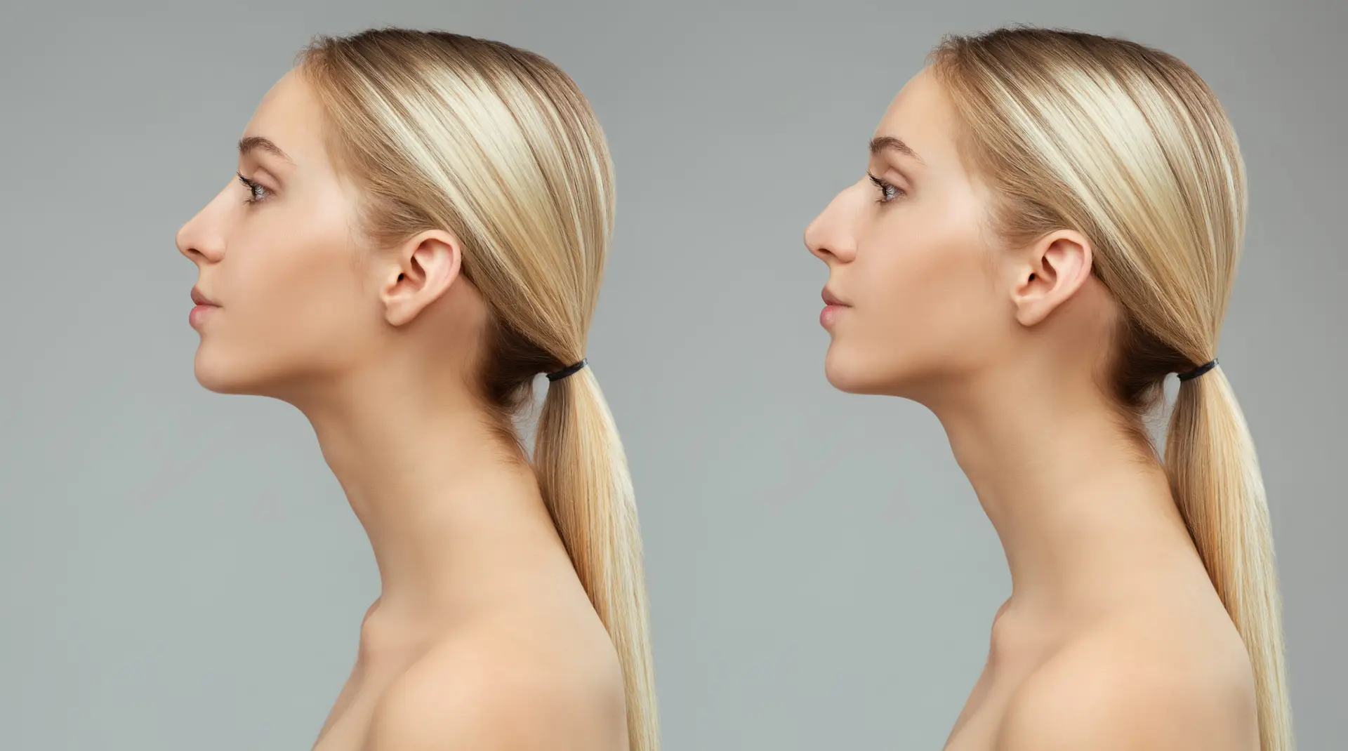 Rhinoplasty Surgery in Seoul, South Korea by Asan Medical Center