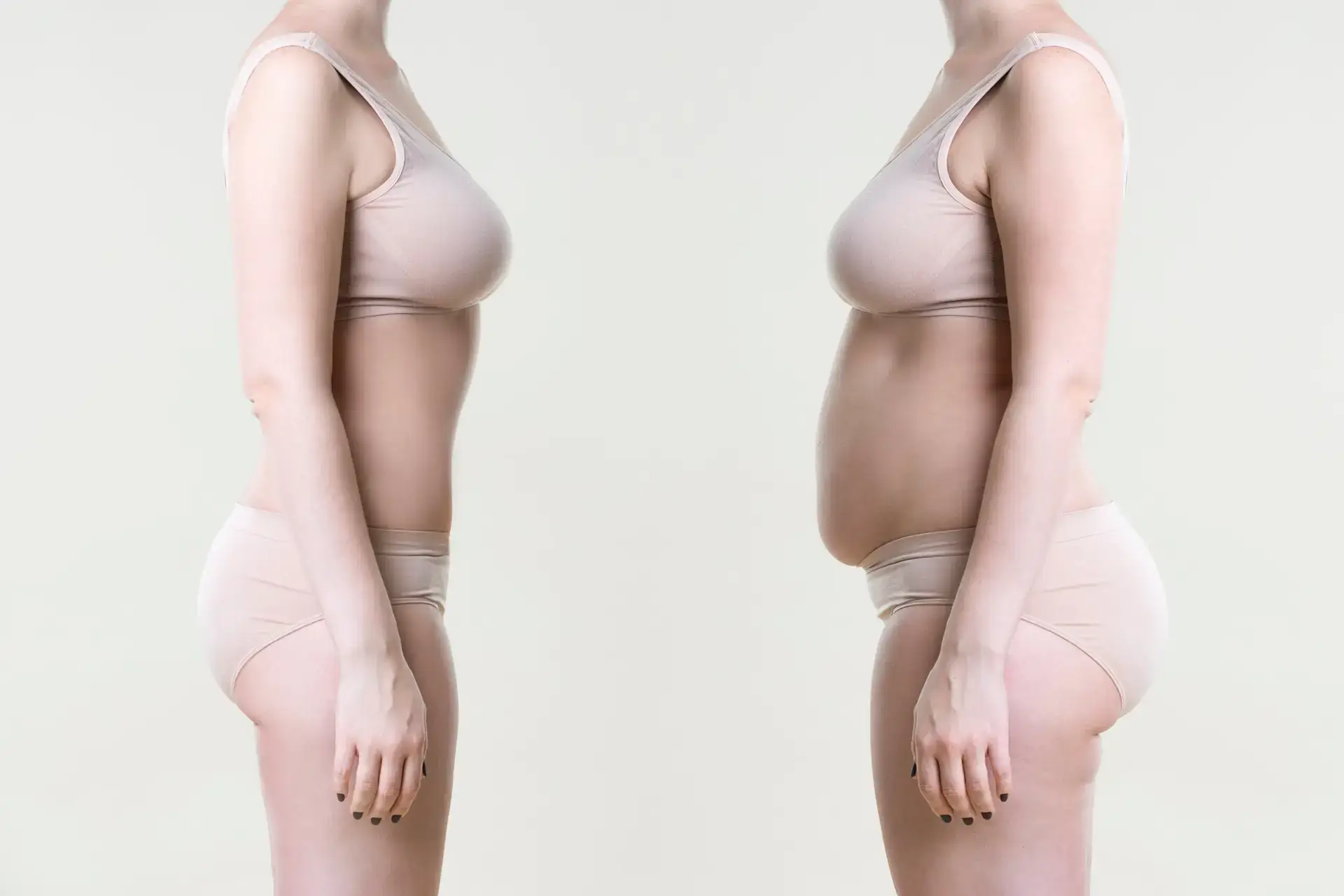 Liposculpture in San Jose