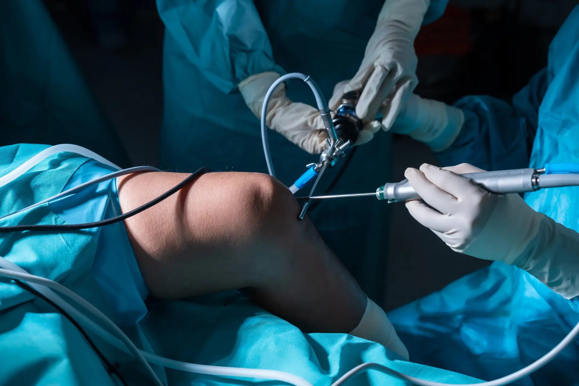 Knee Arthroscopy in Istanbul