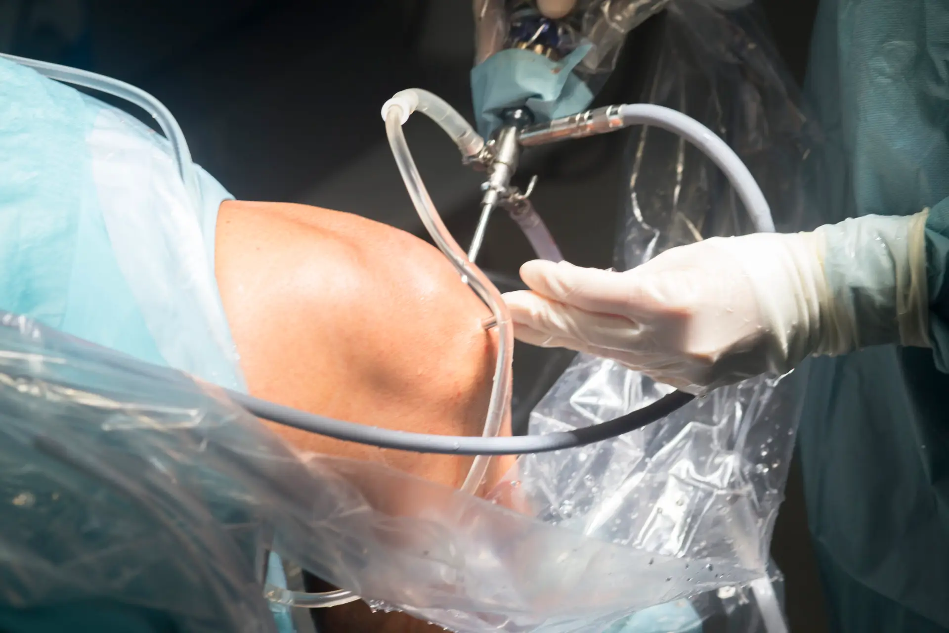 Knee Arthroscopy in Rio de Janeiro