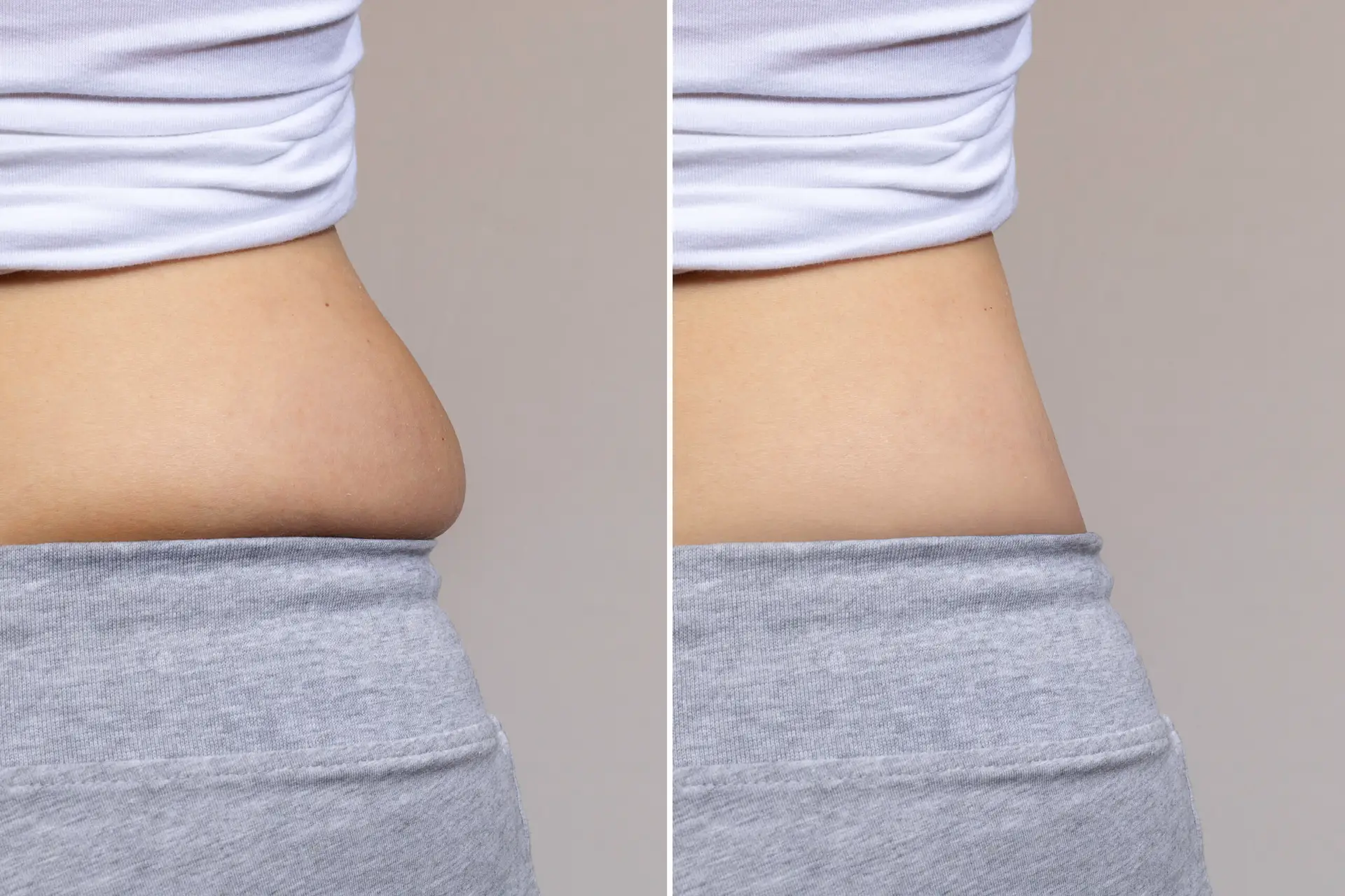 Liposculpture in Sao Paulo