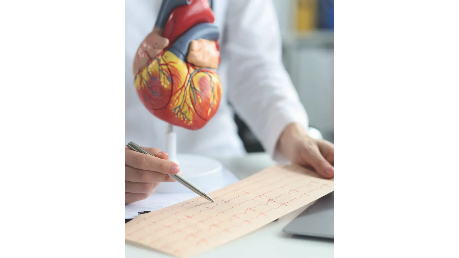Cardiovascular Protocol Package in Limassol, Cyprus by Swissmed Health