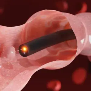 Digestive Endoscopy Clinics and Procedures Abroad