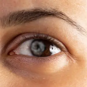Cataract Surgery Clinics and Procedures Abroad