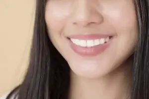 All-on-4/6 Full-Mouth Prosthesis (12–14 Crowns per Arch) in Istanbul, Turkey by Tower Dental Clinic — Dentistry in Turkey