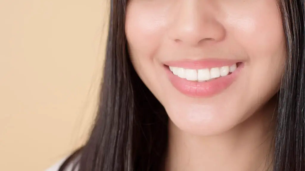 All-on-4/6 Full-Mouth Prosthesis (12–14 Crowns per Arch) in Istanbul, Turkey by Tower Dental Clinic — Dentistry Procedure in Turkey