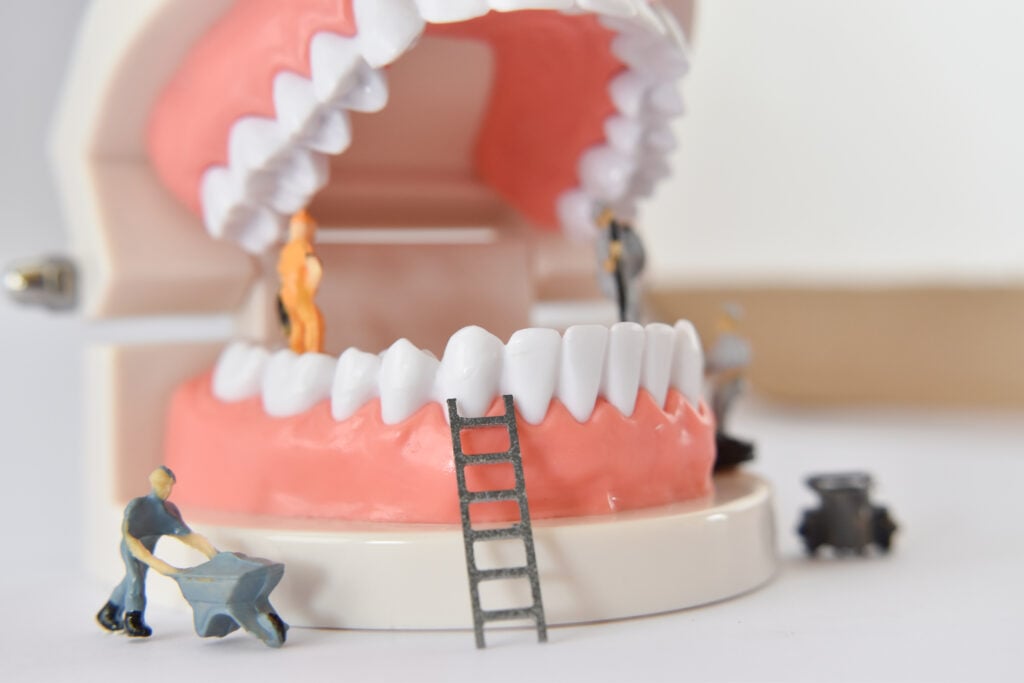 Full Mouth Rehab (up to 28 Zirconia Crowns) in Los Algodones, Mexico by Supreme Dental — Dentistry Procedure in Mexico