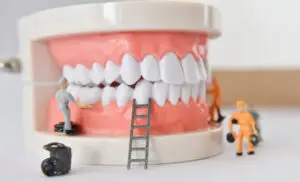 General Dentistry Procedures in Istanbul, Turkey by Tower Dental Clinic — Dentistry in Turkey
