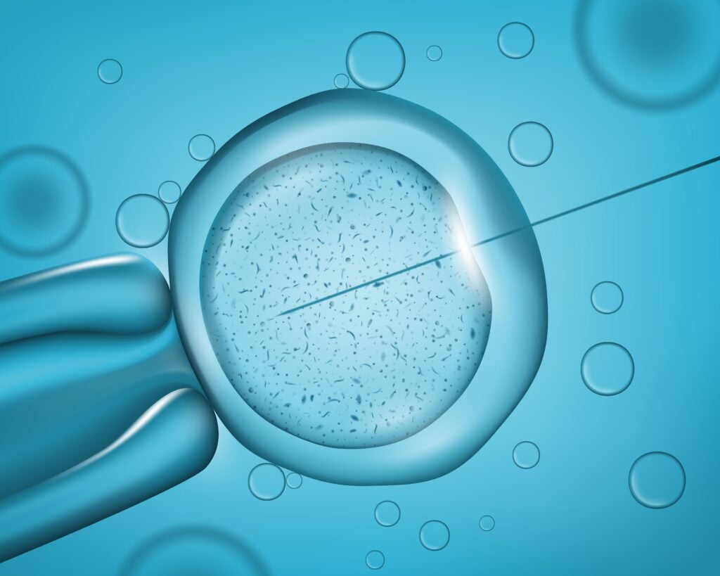 IVF With Egg Donation in Athens, Greece by Ovagenesis — Fertility Procedure in Greece