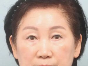 Endotine Forehead Lift in Incheon, South Korea by Elite Plastic Surgery — Plastic Surgery in South Korea