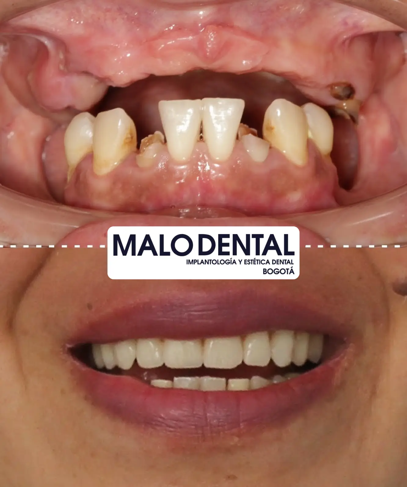 Malo dental clinic meditour 2 1