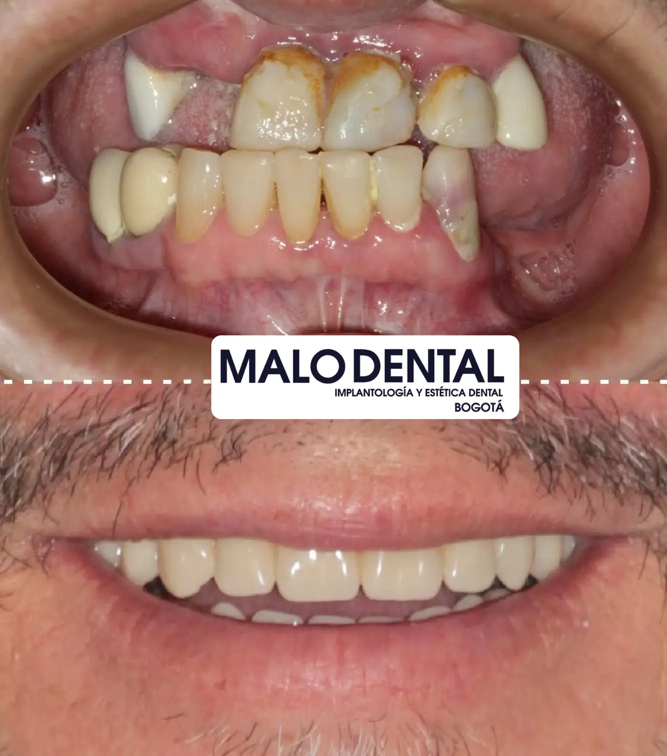 Malo dental clinic meditour8 1