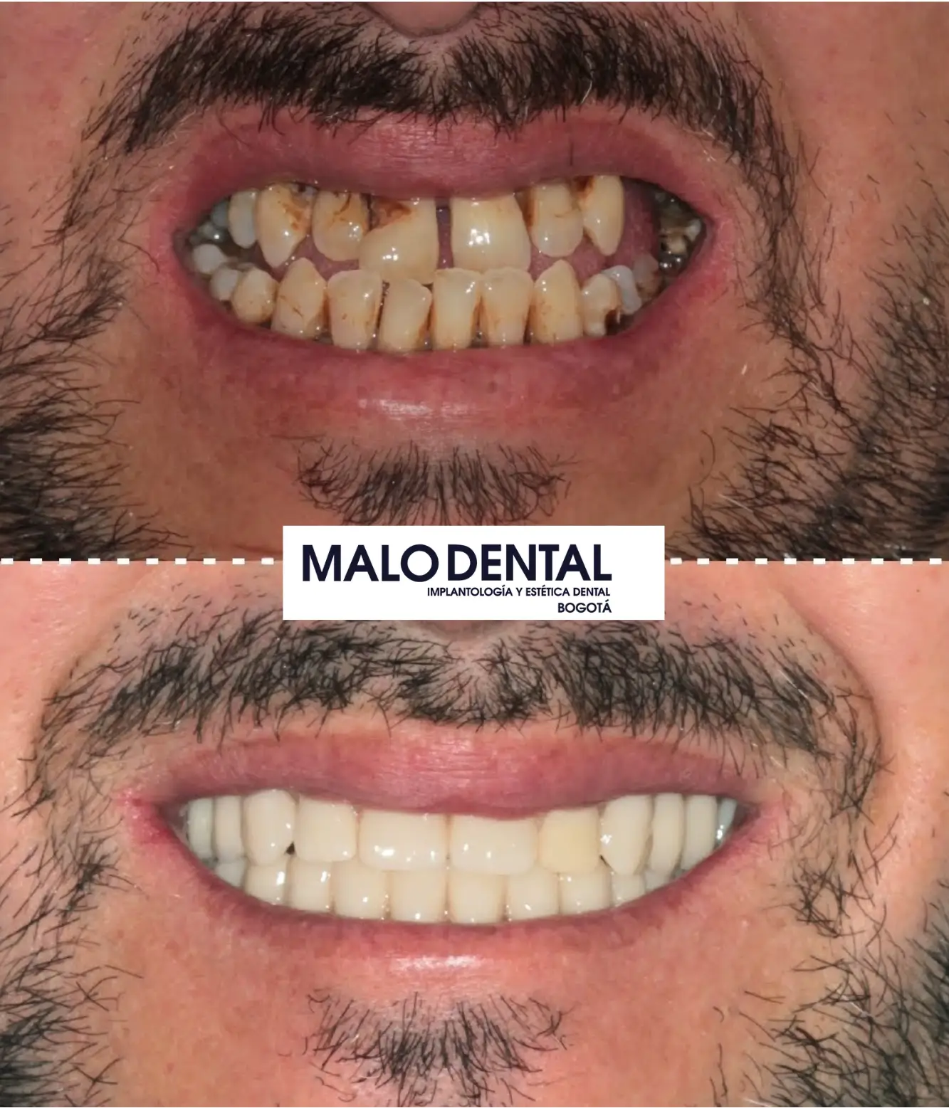 Malo dental clinic meditour9 e1750287581467