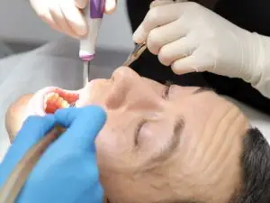 Maxillary Osteotomy in Bogota, Colombia by Malo Dental — Dentistry in Colombia