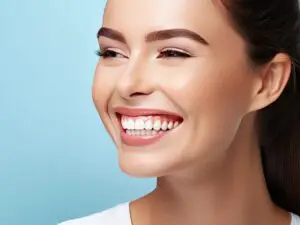 Hollywood Smile with Veneers in Istanbul, Turkey by DentSpa at DentSpa — Dentistry Procedure Abroad