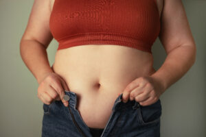 Gastric Band Adjustment (Lap Band) Surgery in Istanbul, Turkey by Medical Park Hospitals — Weight Loss Surgery in Turkey