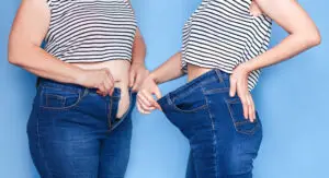 Gastric Bypass in Guadalajara, Mexico by Dr. Stefano Sereno Trabaldo at Dr. Stefano Sereno Trabaldo — Weight Loss Surgery Procedure Abroad