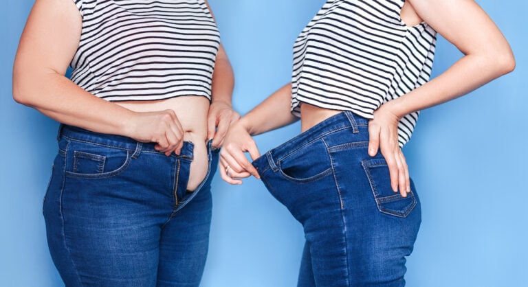 Gastric Bypass in Guadalajara, Mexico by Dr. Stefano Sereno Trabaldo — Weight Loss Surgery Procedure in Mexico