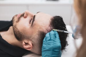 Stem Cell Hair Transplant in Istanbul, Turkey by Memorial Hospital — Hair Restoration Surgery in Turkey