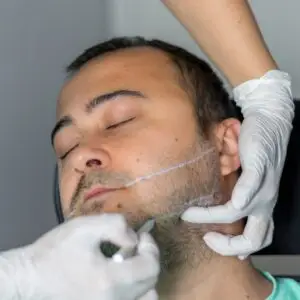 Beard Transplant Clinics and Procedures Abroad