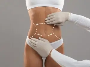 Gastric Bypass Surgery (Roux-en-Y) in Istanbul, Turkey by Medical Park Hospitals — Weight Loss Surgery in Turkey