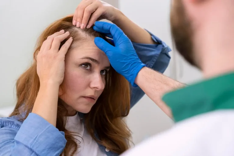Hair Transplant for Women in Istanbul, Turkey by Memorial Hospital — Hair Restoration Surgery Procedure in Turkey