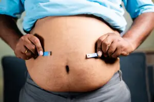 Gastric Plication (Folding) Surgery in Istanbul, Turkey by Medical Park Hospitals