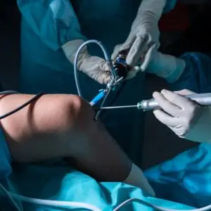 Arthroscopy Clinics and Procedures Abroad