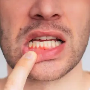 Periodontal Clinics and Procedures Abroad