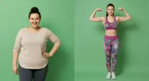 Gastric Sleeve in Istanbul, Turkey by International Plus — Weight Loss Surgery in Turkey