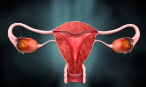 HSG (Hysterosalpingography) in Famagusta, Cyprus by Cyprus IVF Hospital