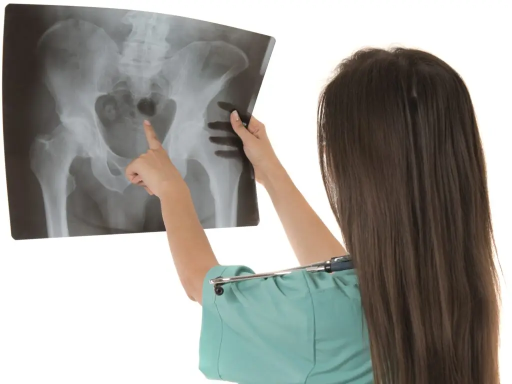 Total Hip Replacement in San Jose, Costa Rica by Clinica Biblica Hospital — Orthopedics Procedure in Costa Rica