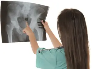 Total Hip Replacement in San Jose, Costa Rica by Clinica Biblica Hospital — Orthopedics in Costa Rica