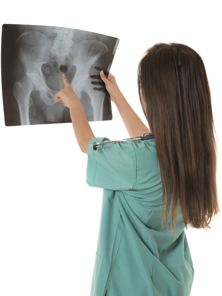 Total Hip Replacement in San Jose, Costa Rica by Clinica Biblica Hospital — Orthopedics Procedure in Costa Rica