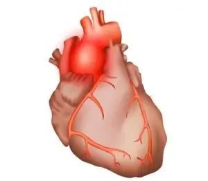Aortic Aneurysm Surgery Clinics and Procedures Abroad