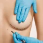 best country for breast augmentation