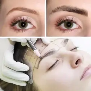 Eyebrow Transplantation Clinics and Procedures Abroad