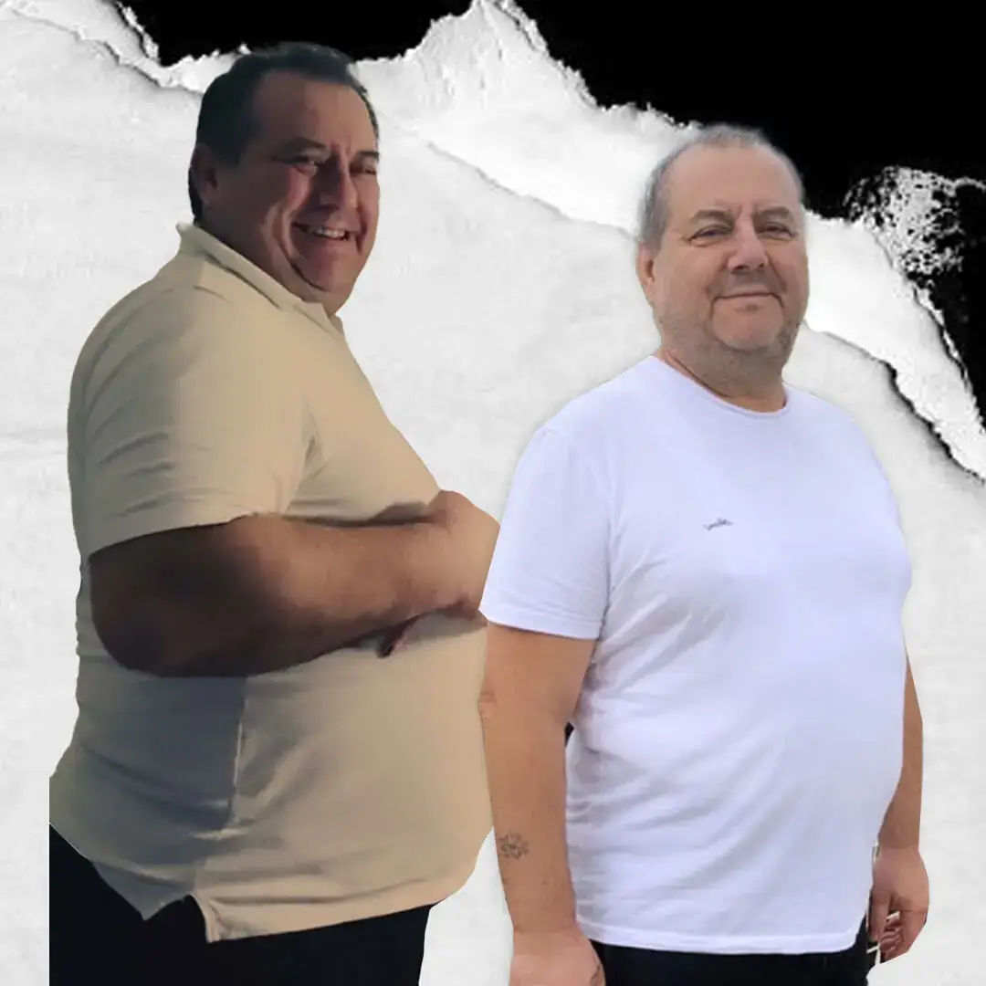 Gastric Sleeve in Istanbul, Turkey by International Plus
