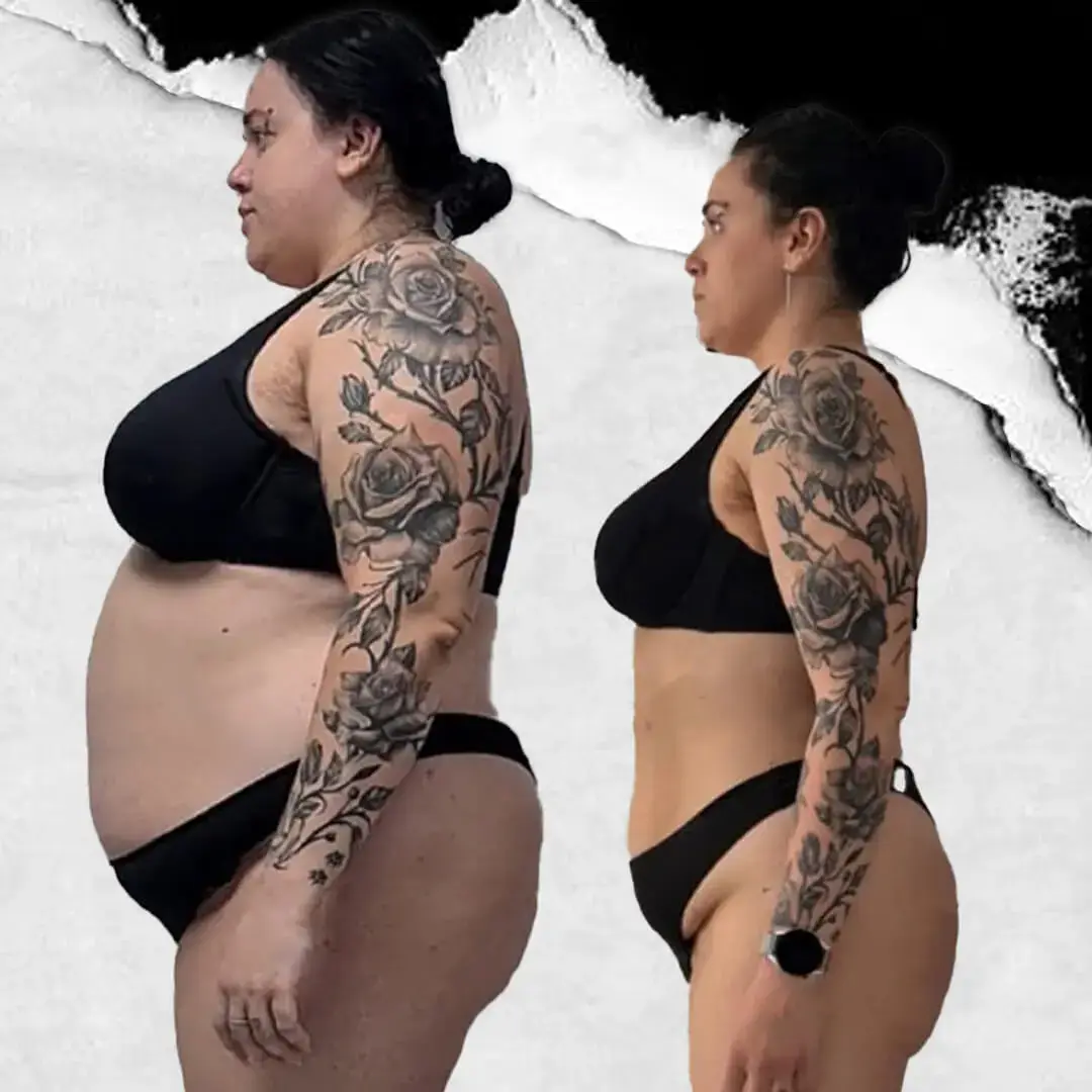 Gastric Sleeve in Istanbul, Turkey by International Plus