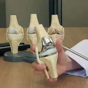 Knee Surgery Clinics and Procedures Abroad