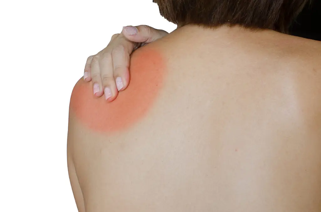 Shoulder Joint Replacement in San Jose, Costa Rica by Clinica Biblica Hospital — Orthopedics Procedure in Costa Rica