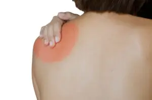 Shoulder Joint Replacement in San Jose, Costa Rica by Clinica Biblica Hospital — Orthopedics in Costa Rica