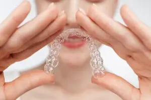 Aligners in San Rafael, Costa Rica by Aesthetic Dental Clinic — Dentistry in Costa Rica