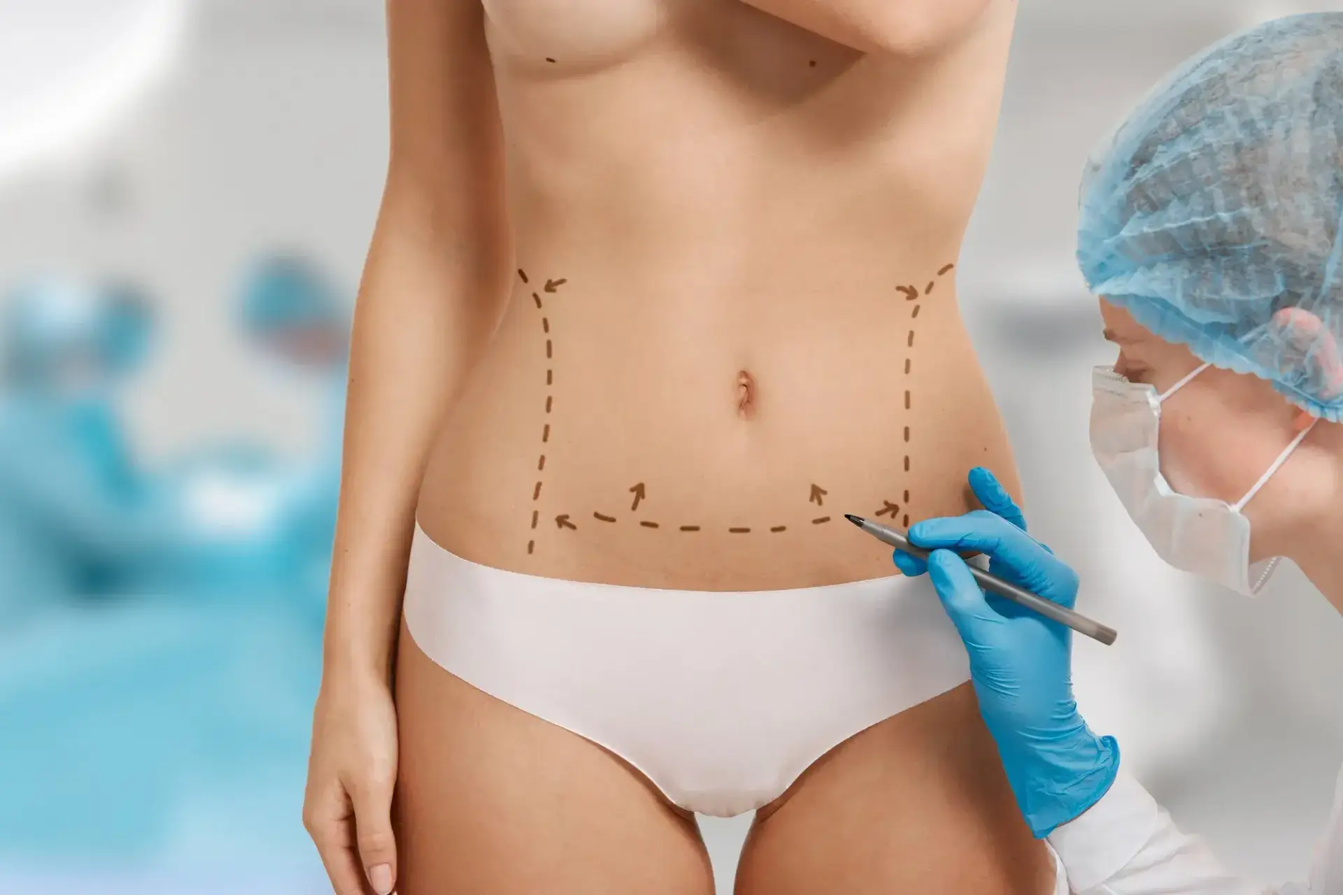 Best Countries for Tummy Tuck in the World