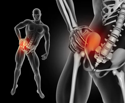 Cheapest Countries for Hip Replacement Surgery