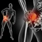 Cheapest Countries for Hip Replacement Surgery 85x85