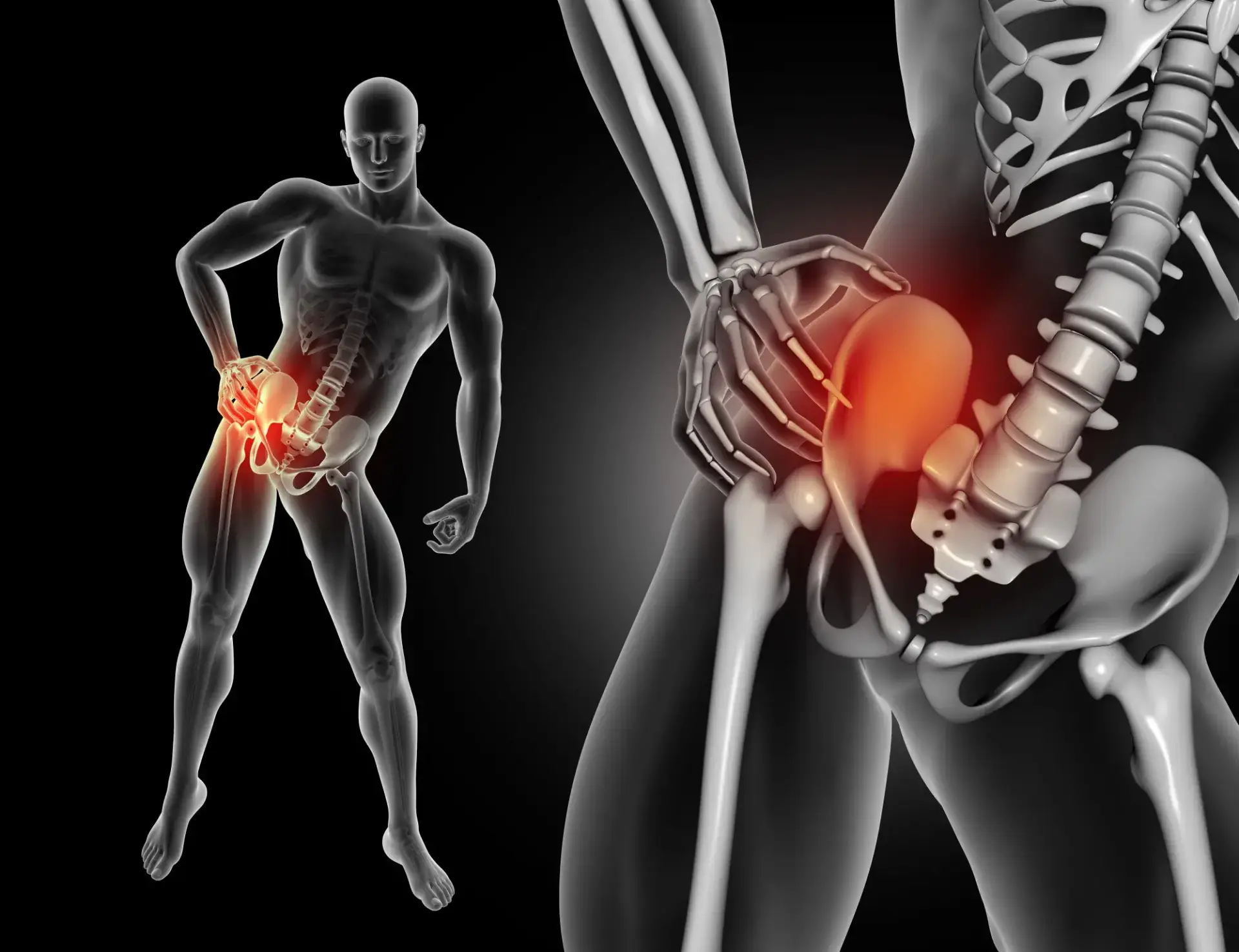 Cheapest Countries for Hip Replacement Surgery